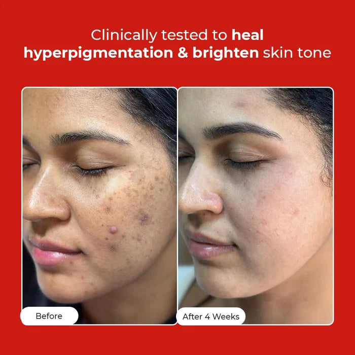5 Antioxidant Skin Brightening Serum | 50 ml | Best Deal