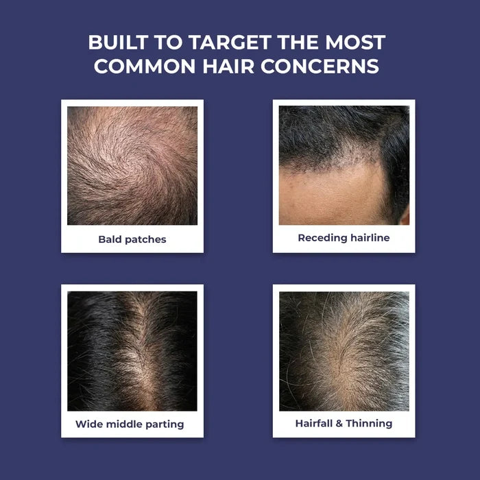 Anti-Hairfall Shampoo