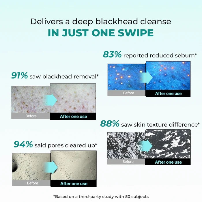 Blackhead Melting Water + Toolkit |  130 ml + 1  Nos. | Super Saver Sale