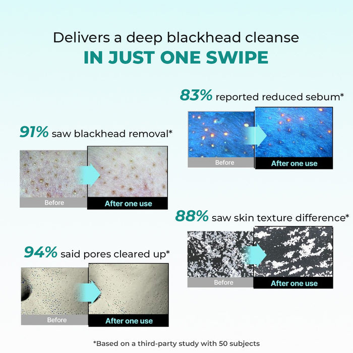 Blackhead Removal Combo | Blackhead Melting Water Mini (Pack of 2) + Blackhead Remover Toolkit | 2x50 ml + 1 Toolkit