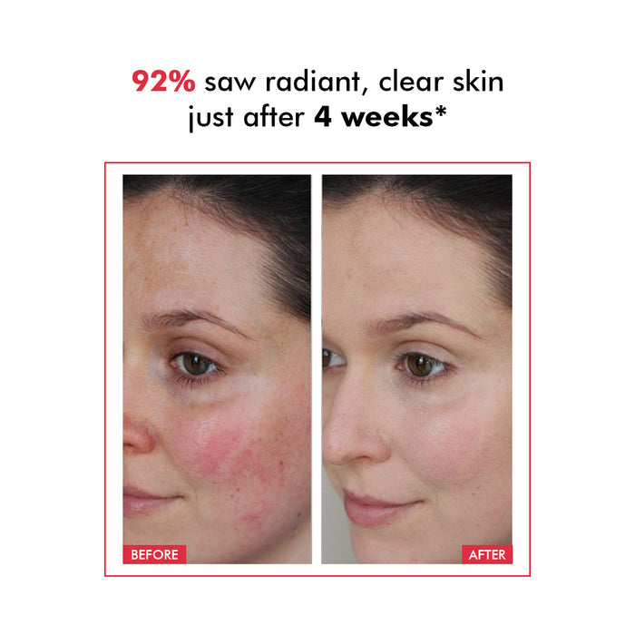 Derm Date Resurfacing Chemical Peel Treatment Serum | 30 ml | Best Deal