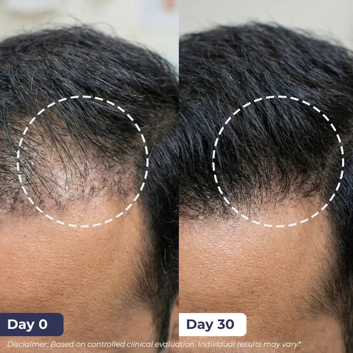 Hair Growth Duo | Shampoo & Serum | Reduces Hairfall & Supports New Hair Growth | combo