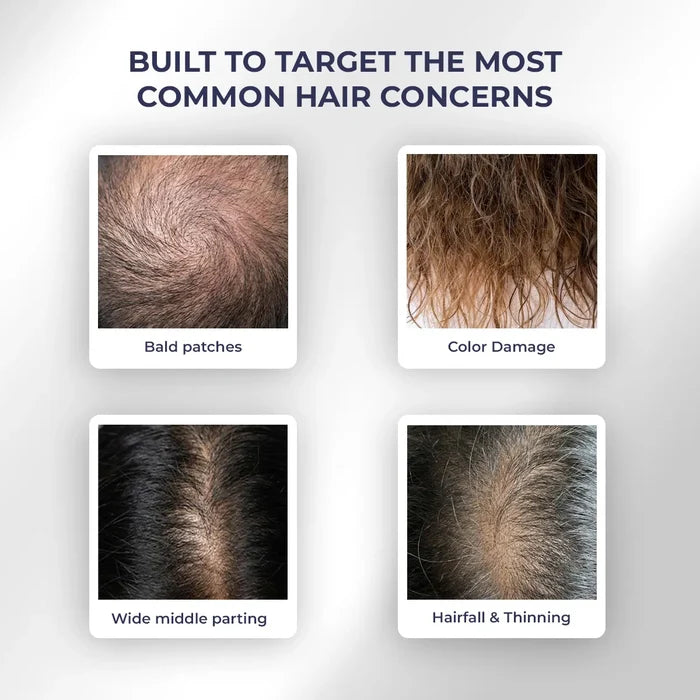 Hair Growth Duo | Shampoo & Serum | Reduces Hairfall & Supports New Hair Growth | flat 50