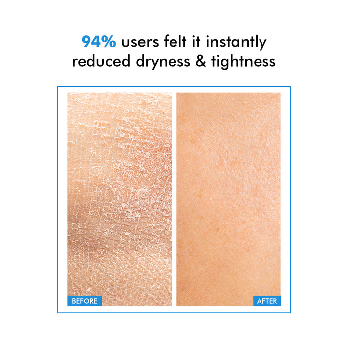 Hydro+ Hydrating & Plumping Serum | 1% Multi-Molecular Hyaluronic Acid | Flash Sale