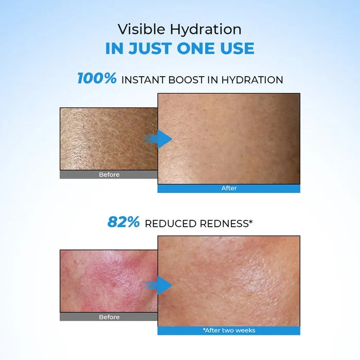 Hydro+ Multi Hyaluronic Acid Moisturiser (Pack Of 2) | 2x100 Gms