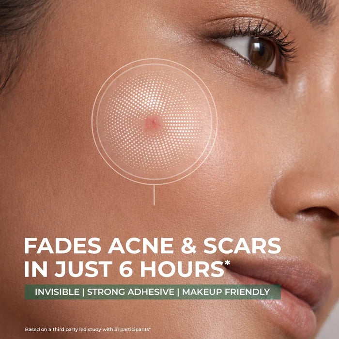 Self Dissolving Microneedle Acne Patches | 8 Patches | Best Deal