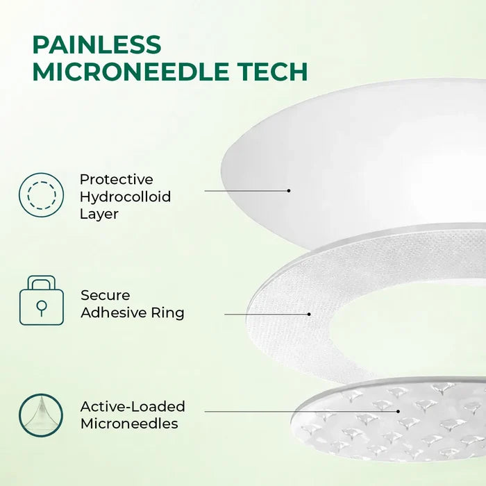 Self Dissolving Microneedle Acne Patches | 8 Patches | Best Deal