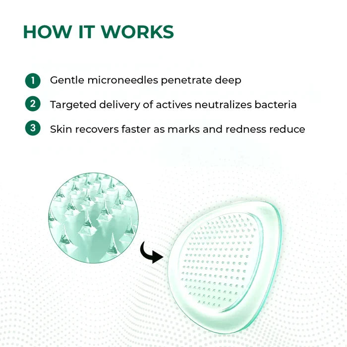 Self Dissolving Microneedle Acne Patches | 8 Patches | Best Deal