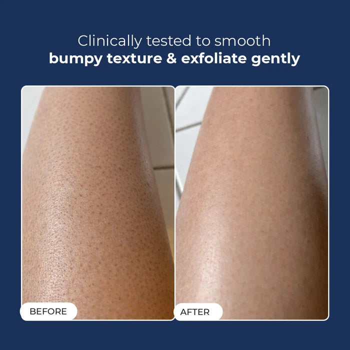 Skin Reset Exfoliating Bodywash | Flash Sale