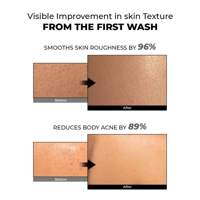 Skin Reset Exfoliating Bodywash