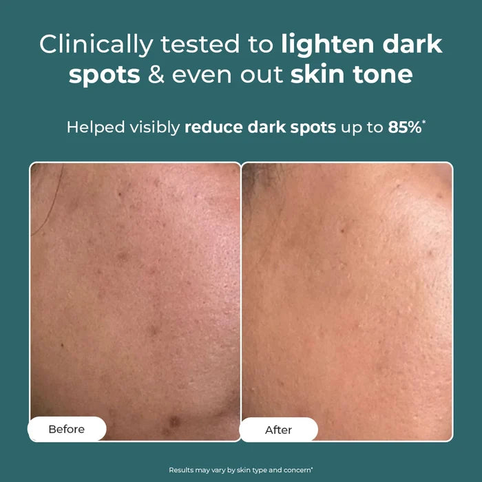 Trubiom Dark Spot Corrector Gel Cream | Special Offer