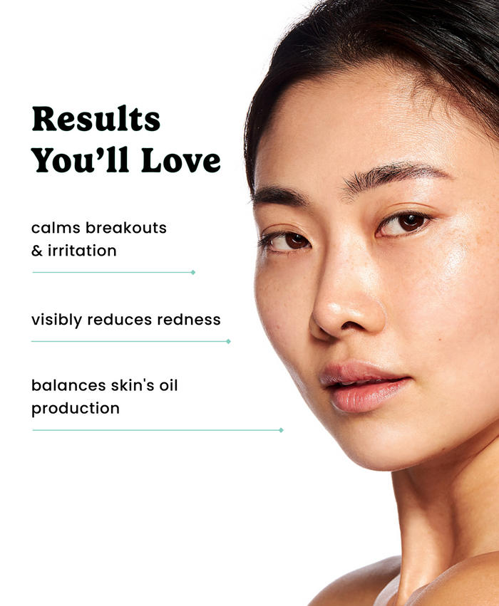 Close-up model with text: calms breakouts and irritation, reduces redness, balances oil production