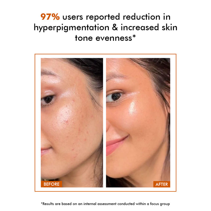 Vivid C | 10% Vitamin C Skin Brightening Serum | Flash Sale